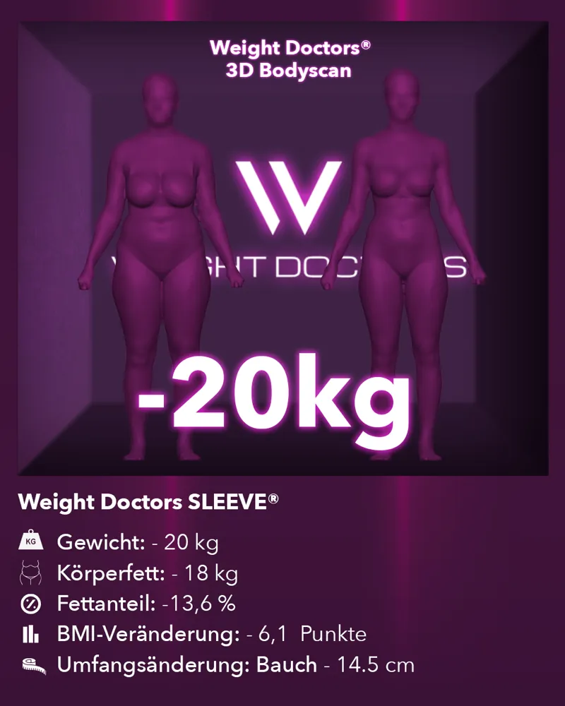 Weight Doctors® 3D-Bodyscan vorher und nachher: minus 20 kg mit Weight Doctors SLEEVE®, Körperfett minus 18 kg