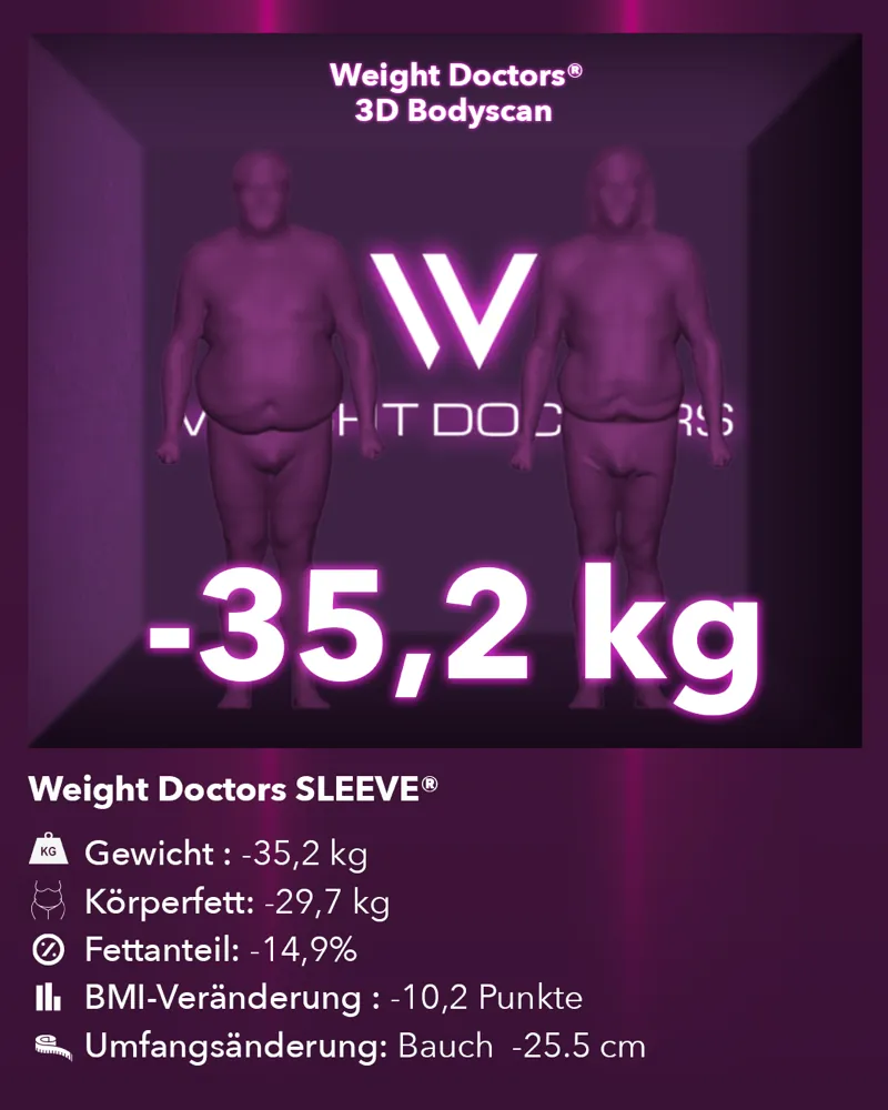 Weight Doctors® 3D-Bodyscan vorher und nachher: minus 35,2 kg mit Weight Doctors SLEEVE®, Körperfett minus 29,7 kg