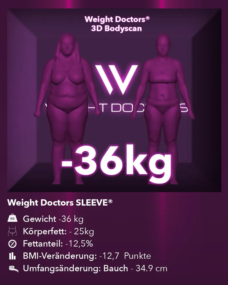 Weight Doctors® 3D-Bodyscan vorher und nachher: minus 36 kg mit Weight Doctors SLEEVE®, Körperfett minus 25 kg