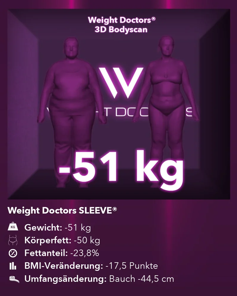 Weight Doctors® 3D-Bodyscan vorher und nachher: minus 51 kg mit Weight Doctors SLEEVE®, Körperfett minus 50 kg