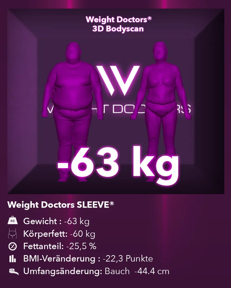 Weight Doctors® 3D-Bodyscan vorher und nachher: minus 63 kg mit Weight Doctors SLEEVE®, Körperfett minus 60 kg