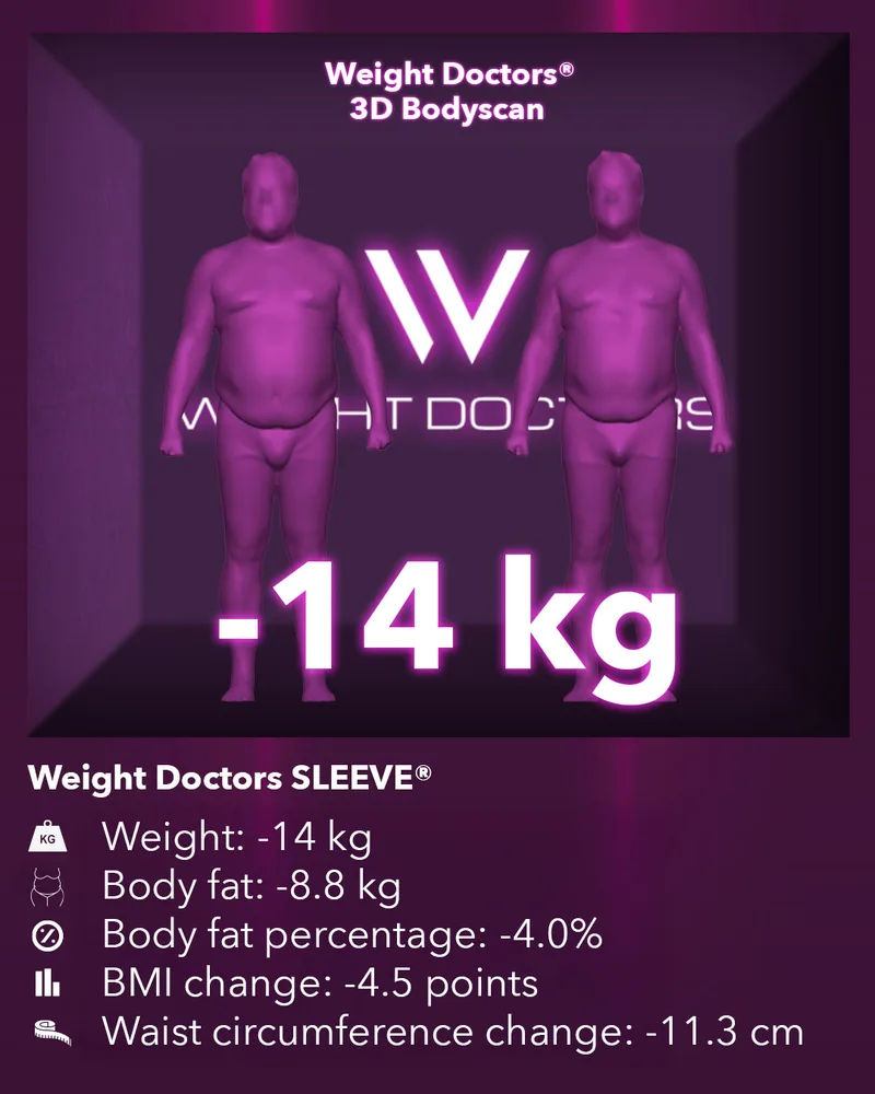Weight Doctors® 3D Bodyscan before and after: minus 14 kg with Weight Doctors SLEEVE®, body fat minus 8.8 kg
