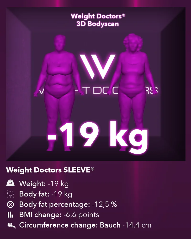 Weight Doctors® 3D Bodyscan before and after: minus 19 kg with Weight Doctors SLEEVE®, body fat minus 19 kg
