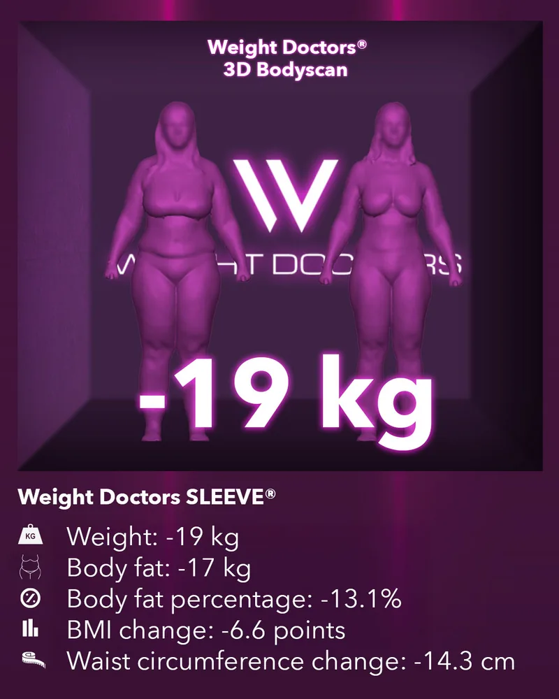 Weight Doctors® 3D Bodyscan before and after: minus 19 kg with Weight Doctors SLEEVE®, body fat minus 17 kg