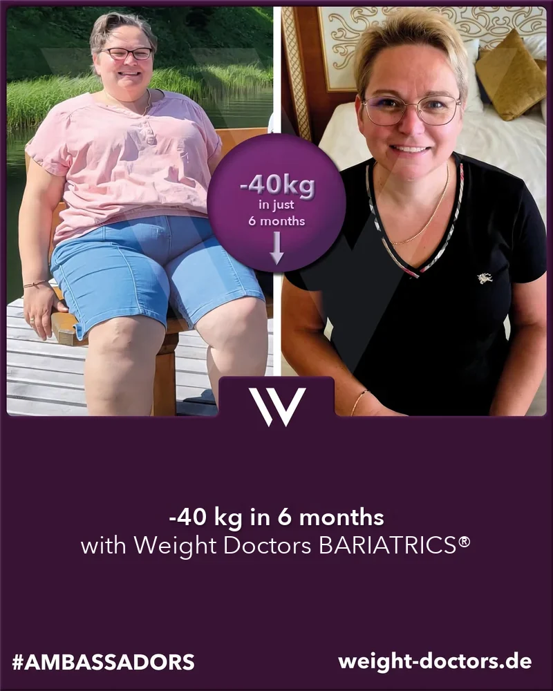Weight Doctors® before and after: female patient 40 kg lighter in six months, with Weight Doctors BARIATRICS®