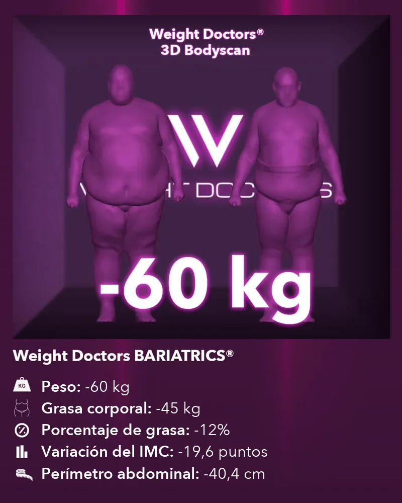 Weight Doctors® 3D Bodyscan antes y después: 60 kg menos con Weight Doctors BARIATRICS®, 45 kg menos de grasa corporal
