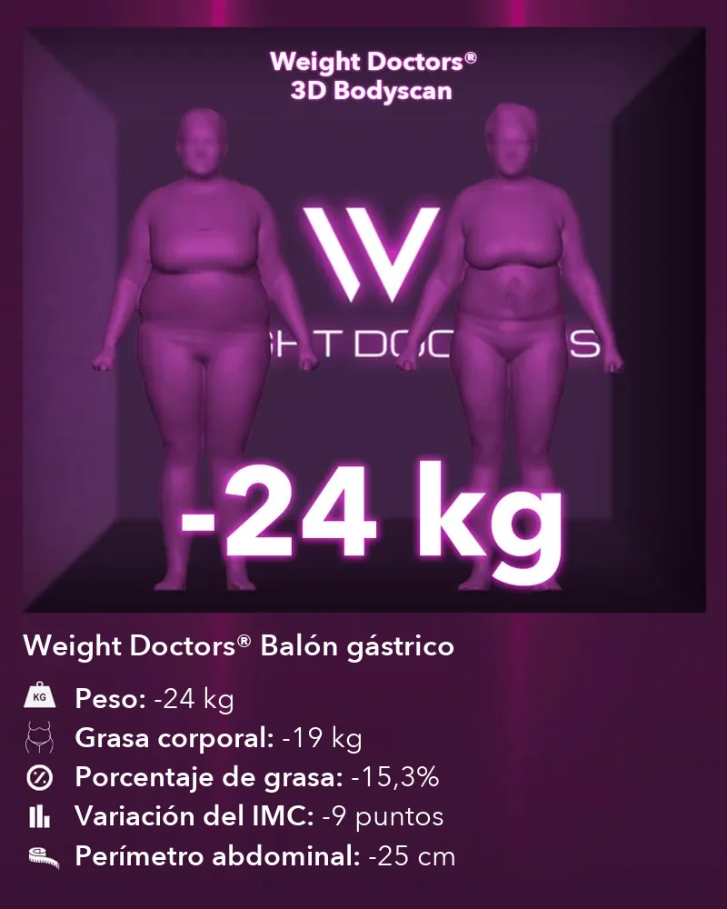 Weight Doctors® 3D Bodyscan antes y después: 24 kg menos con el Weight Doctors® BALÓN GÁSTRICO, 19 kg menos de grasa corporal