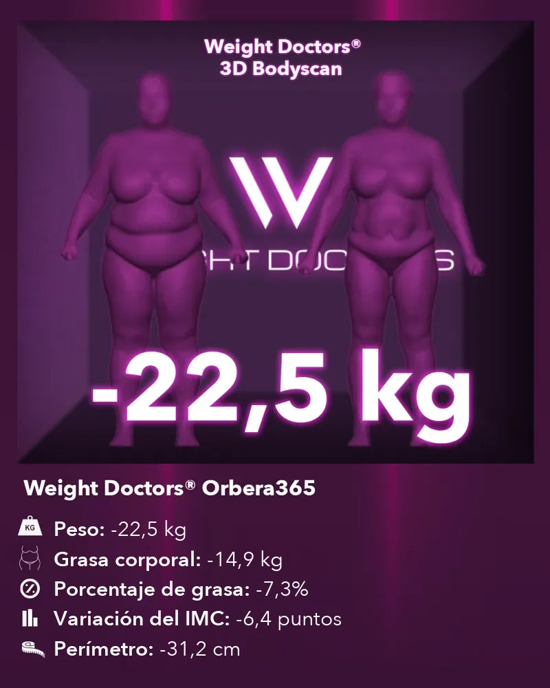 Weight Doctors® 3D Bodyscan antes y después: 22,5 kg menos con el balón gástrico Orbera365, 14,9 kg menos de grasa corporal