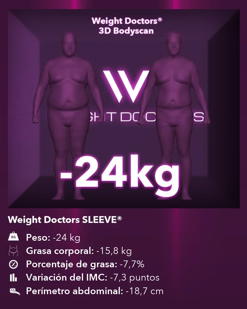 Weight Doctors® 3D Bodyscan antes y después: 24 kg menos con Weight Doctors SLEEVE®, 15,8 kg menos de grasa corporal