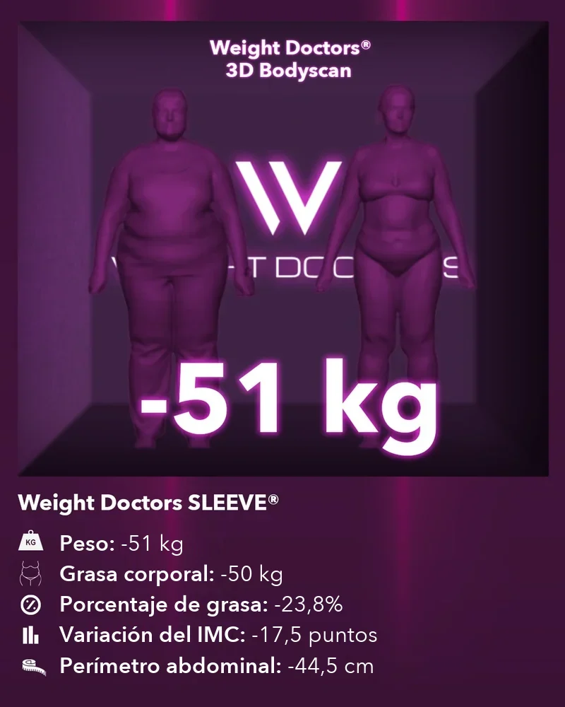 Weight Doctors® 3D Bodyscan antes y después: 51 kg menos con Weight Doctors SLEEVE®, 50 kg menos de grasa corporal