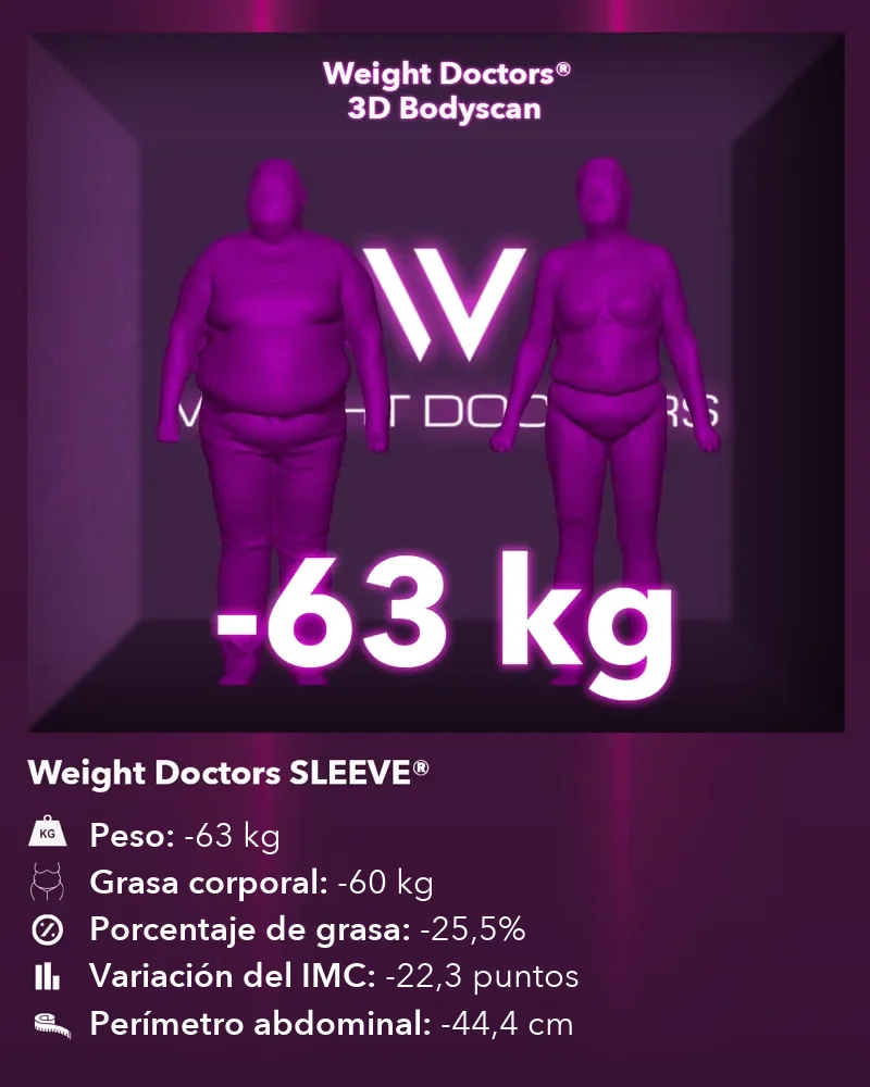 Weight Doctors® 3D Bodyscan antes y después: 63 kg menos con Weight Doctors SLEEVE®, 60 kg menos de grasa corporal