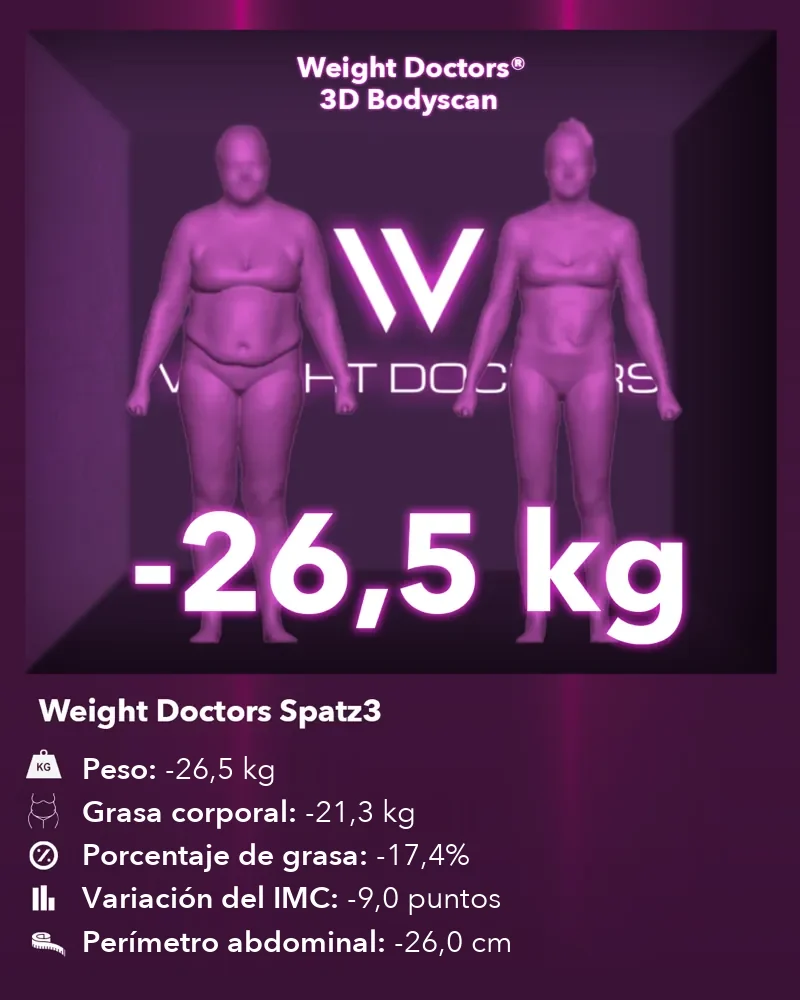 Weight Doctors® 3D Bodyscan antes y después: 26,5 kg menos con el balón gástrico Spatz3, 21,3 kg menos de grasa corporal