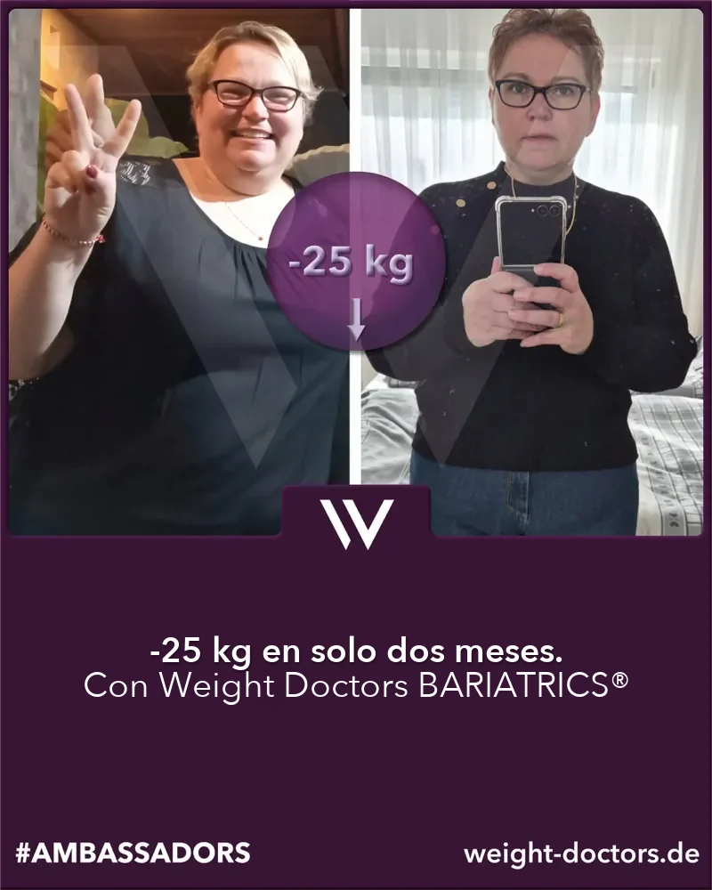 Weight Doctors® antes y después: paciente con 25 kg menos en dos meses, con Weight Doctors BARIATRICS®
