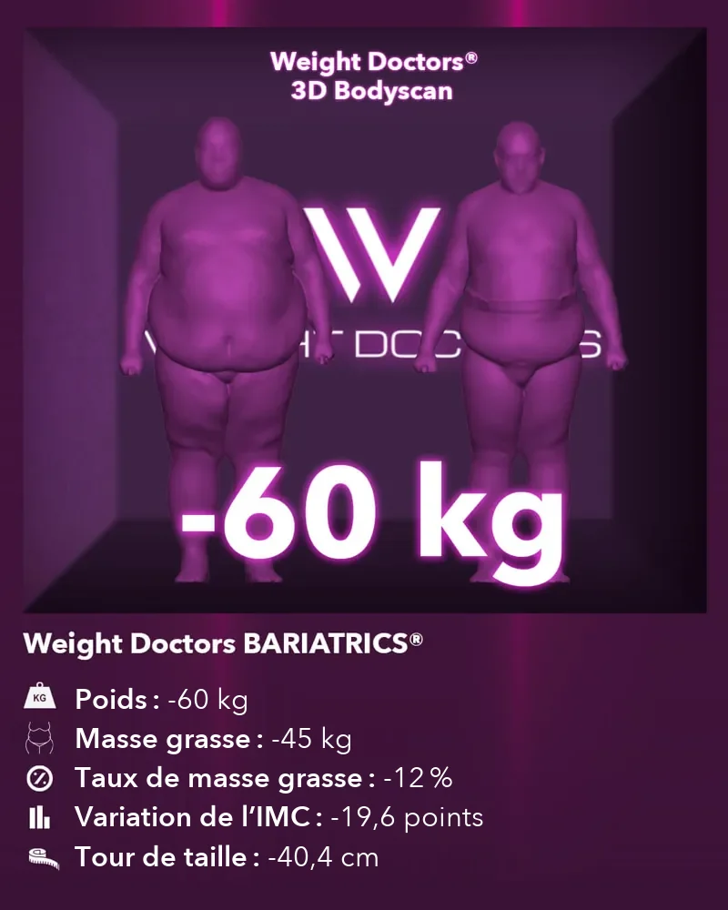 Weight Doctors® 3D Bodyscan avant et après&nbsp;: moins 60 kg avec Weight Doctors BARIATRICS®, masse grasse moins 45 kg