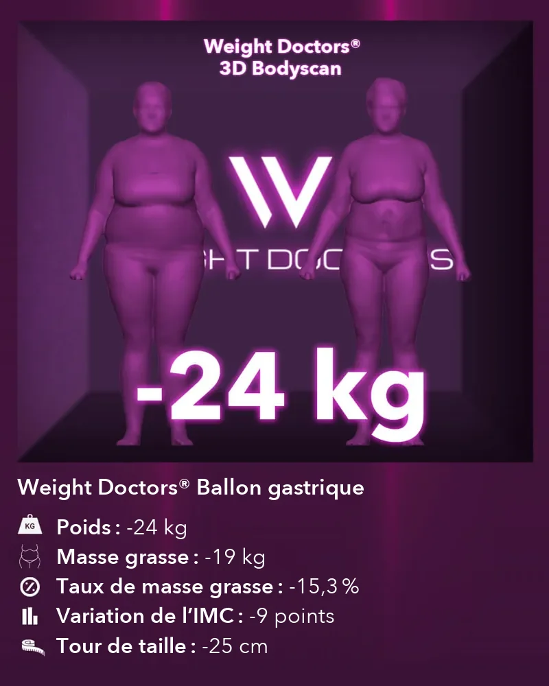 Weight Doctors® 3D Bodyscan avant et après&nbsp;: moins 24 kg avec le Weight Doctors® BALLON GASTRIQUE, masse grasse moins 19 kg