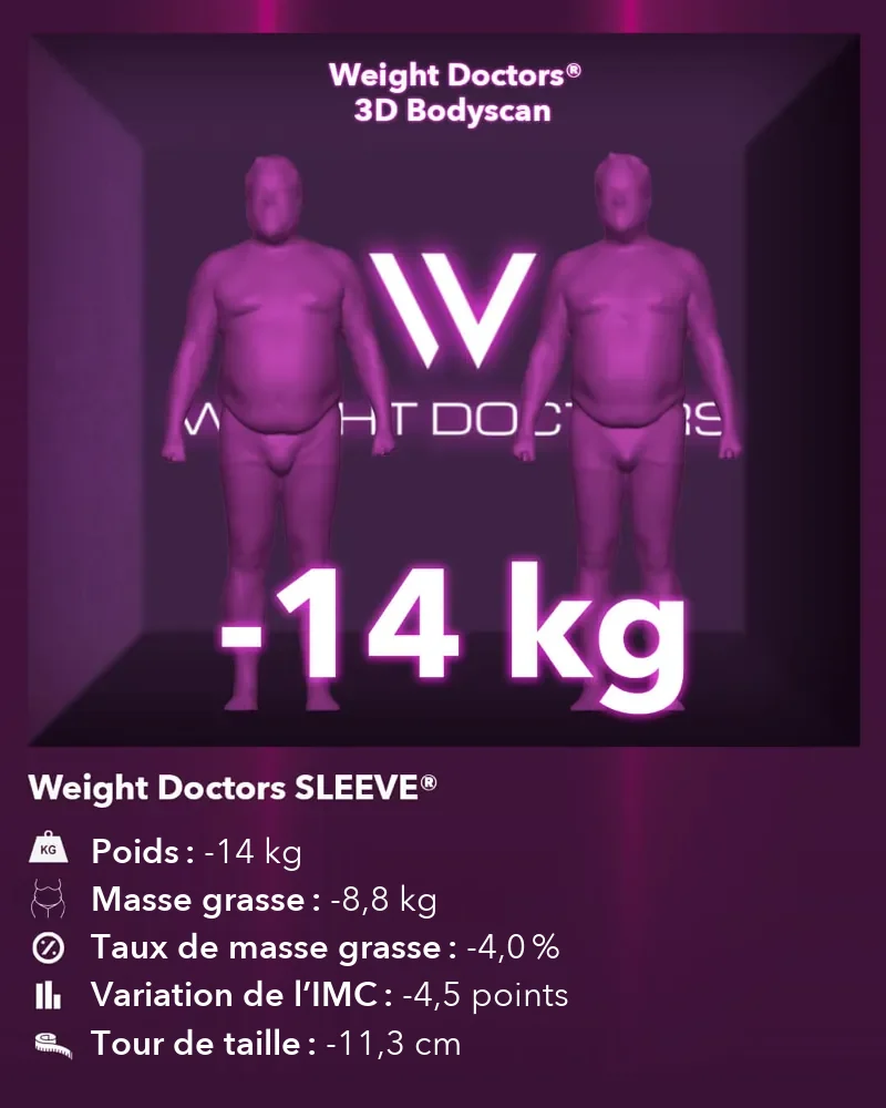 3D Bodyscan Weight Doctors® avant et après&nbsp;: moins 14 kg avec le Weight Doctors SLEEVE®, graisse corporelle moins 8,8 kg