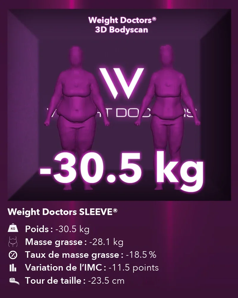 Weight Doctors® 3D Bodyscan avant et après&nbsp;: moins 30,5 kg avec Weight Doctors SLEEVE®, masse grasse moins 28,1 kg