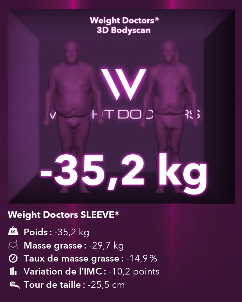 Weight Doctors® 3D Bodyscan avant et après&nbsp;: moins 35,2 kg avec Weight Doctors SLEEVE®, masse grasse moins 29,7 kg