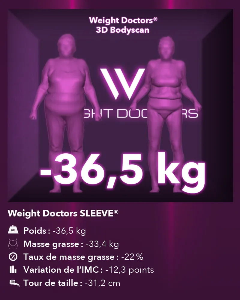 Weight Doctors® 3D Bodyscan avant et après&nbsp;: moins 36,5 kg avec Weight Doctors SLEEVE®, masse grasse moins 33,4 kg