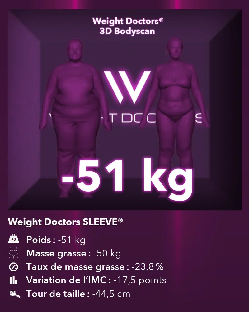Weight Doctors® 3D Bodyscan avant et après&nbsp;: moins 51 kg avec Weight Doctors SLEEVE®, masse grasse moins 50 kg