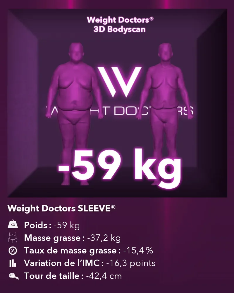 Weight Doctors® 3D Bodyscan avant et après&nbsp;: moins 59 kg avec Weight Doctors SLEEVE®, masse grasse moins 37,2 kg