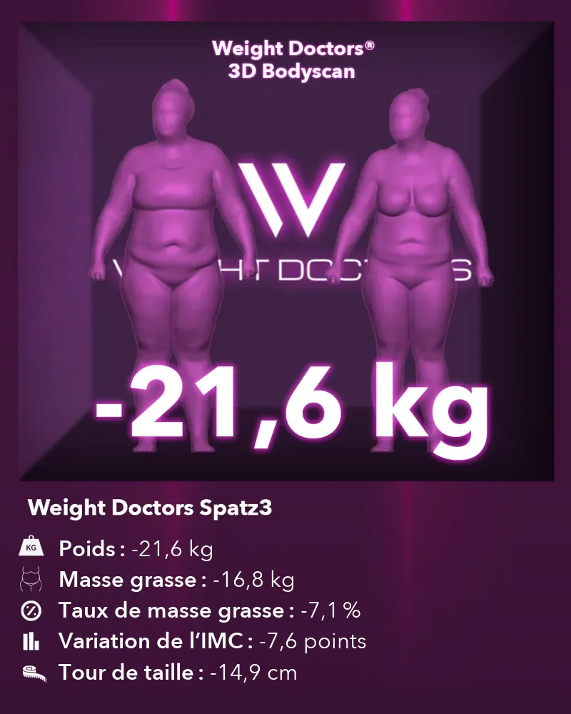 Weight Doctors® 3D Bodyscan avant et après&nbsp;: moins 21,6 kg avec le ballon gastrique Spatz3, masse grasse moins 16,8 kg