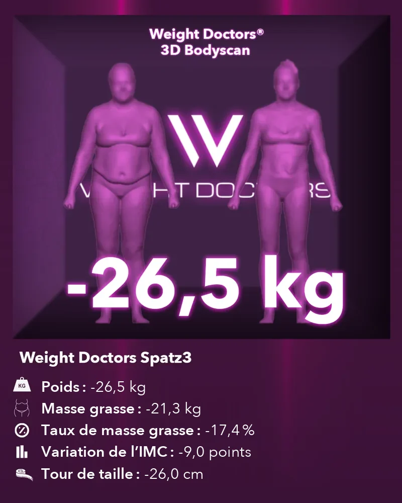 Weight Doctors® 3D Bodyscan avant et après&nbsp;: moins 26,5 kg avec le ballon gastrique Spatz3, masse grasse moins 21,3 kg