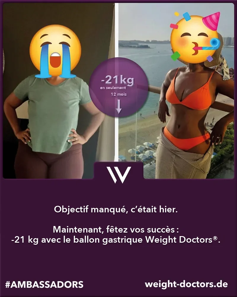 Avant-après Weight Doctors®&nbsp;: une patiente avec 21 kg de moins en douze mois, avec le Weight Doctors® BALLON GASTRIQUE (visages masqués)