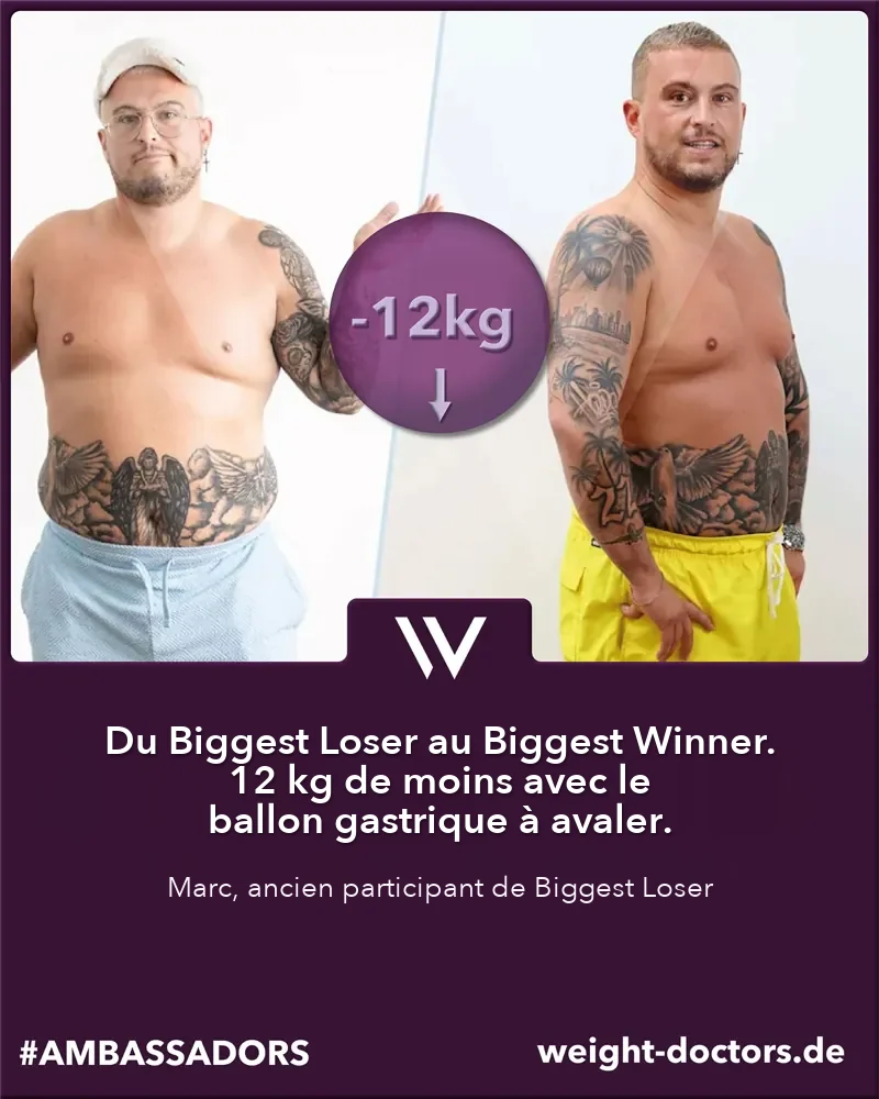 Weight Doctors® avant-après&nbsp;: Marc, ancien participant de «&nbsp;The Biggest Loser », 12 kg en moins avec le ballon gastrique Allurion