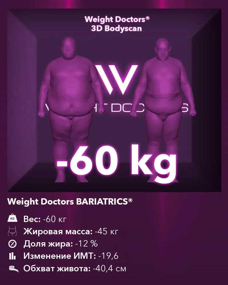 Weight Doctors® 3D Bodyscan до и после: минус 60 кг с Weight Doctors BARIATRICS®, жировая масса минус 45 кг