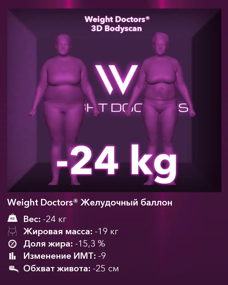 Weight Doctors® 3D Bodyscan до и после: минус 24 кг с Weight Doctors® ЖЕЛУДОЧНЫЙ БАЛЛОН, жировая масса минус 19 кг