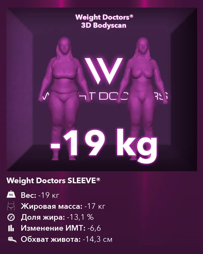 Weight Doctors® 3D Bodyscan до и после: минус 19 кг с Weight Doctors SLEEVE®, жировая масса минус 17 кг