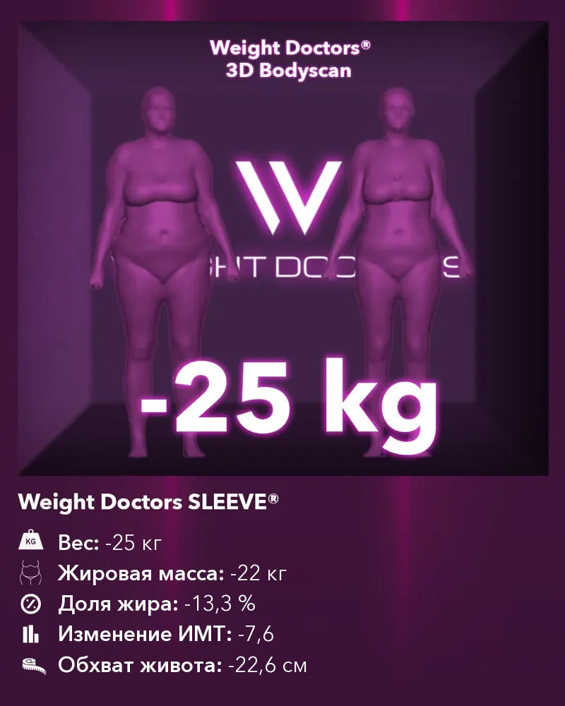 Weight Doctors® 3D Bodyscan до и после: минус 25 кг с Weight Doctors SLEEVE®, жировая масса минус 22 кг