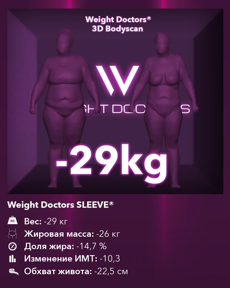 Weight Doctors® 3D Bodyscan до и после: минус 29 кг с Weight Doctors SLEEVE®, жировая масса минус 26 кг