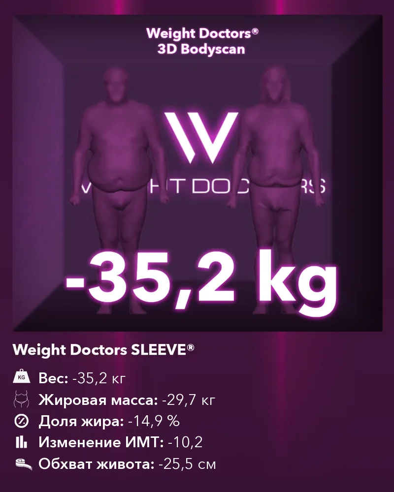 Weight Doctors® 3D Bodyscan до и после: минус 35,2 кг с Weight Doctors SLEEVE®, жировая масса минус 29,7 кг