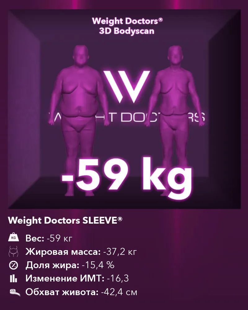 Weight Doctors® 3D Bodyscan до и после: минус 59 кг с Weight Doctors SLEEVE®, жировая масса минус 37,2 кг