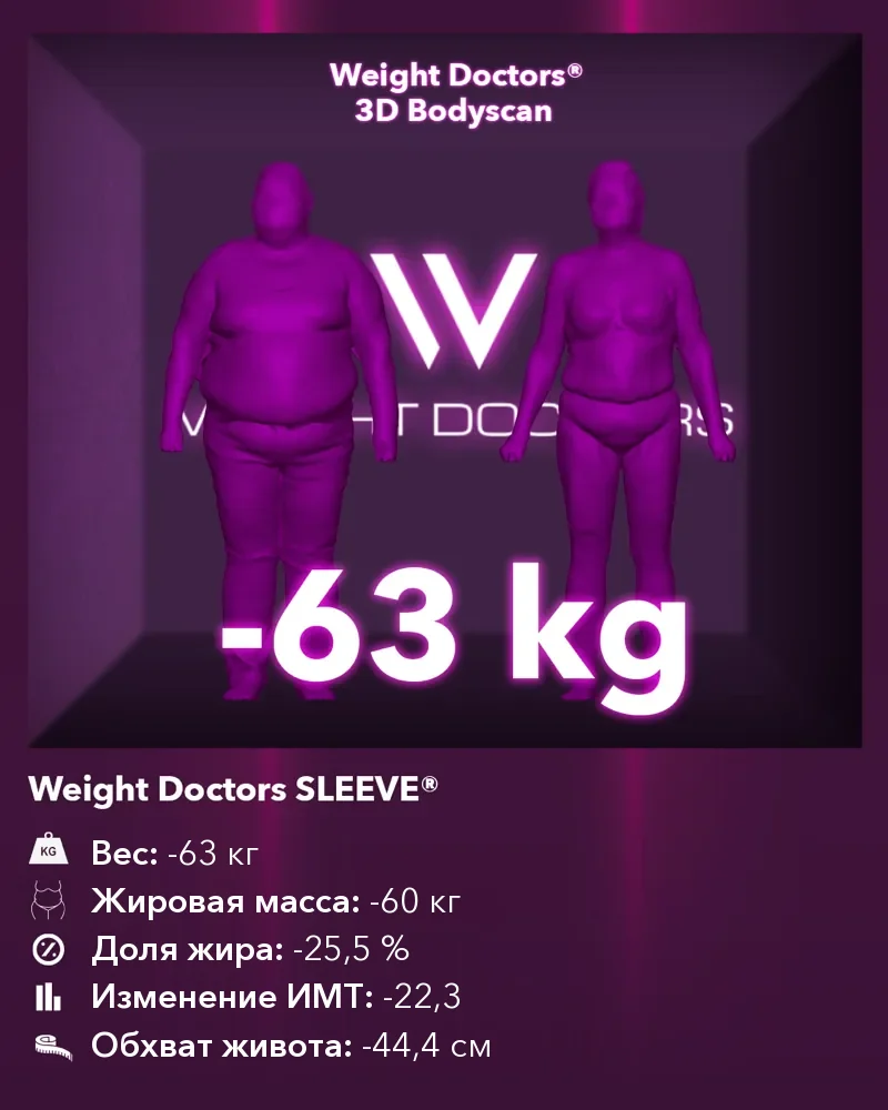 Weight Doctors® 3D Bodyscan до и после: минус 63 кг с Weight Doctors SLEEVE®, жировая масса минус 60 кг
