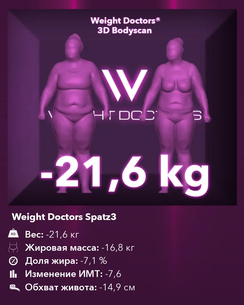 Weight Doctors® 3D Bodyscan до и после: минус 21,6 кг с желудочным баллоном Spatz3, жировая масса минус 16,8 кг