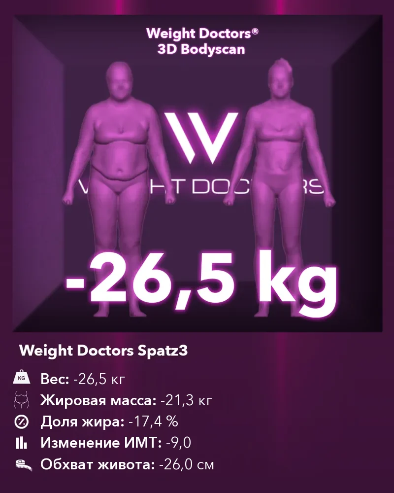 Weight Doctors® 3D Bodyscan до и после: минус 26,5 кг с желудочным баллоном Spatz3, жировая масса минус 21,3 кг