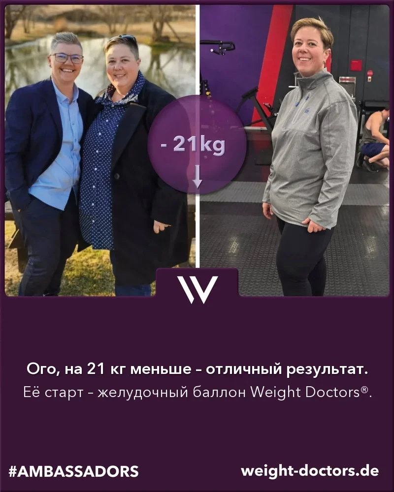 Weight Doctors® до и после: Элли на 21 кг легче с Weight Doctors® ЖЕЛУДОЧНЫЙ БАЛЛОН