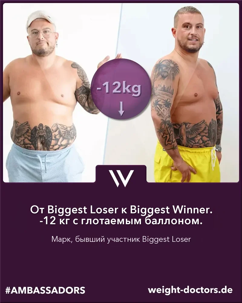 Weight Doctors® до и после: Марк, бывший участник «The Biggest Loser», на 12 кг легче с баллоном Allurion