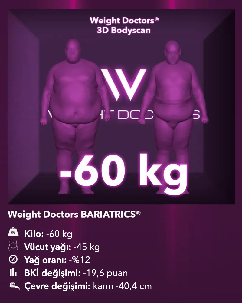 Weight Doctors® 3D Bodyscan öncesi ve sonrası: Weight Doctors BARIATRICS® ile 60 kg eksi, vücut yağı 45 kg eksi