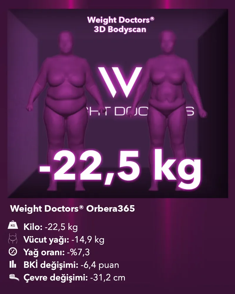 Weight Doctors® 3D Bodyscan öncesi ve sonrası: Orbera365 mide balonuyla 22,5 kg eksi, vücut yağı 14,9 kg eksi