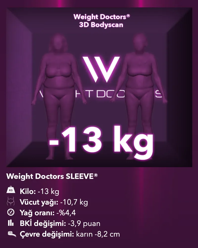 Weight Doctors® 3D Bodyscan öncesi ve sonrası: Weight Doctors SLEEVE® ile 13 kg eksi, vücut yağı 10,7 kg eksi