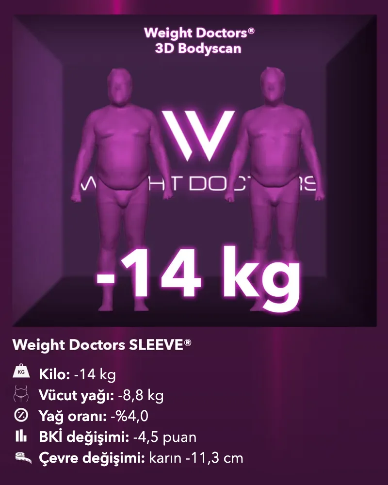 Weight Doctors® 3D Bodyscan öncesi ve sonrası: Weight Doctors SLEEVE® ile 14 kg eksi, vücut yağı 8,8 kg eksi