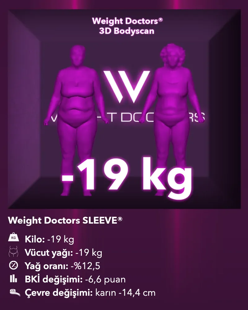 Weight Doctors® 3D Bodyscan öncesi ve sonrası: Weight Doctors SLEEVE® ile 19 kg eksi, vücut yağı 19 kg eksi