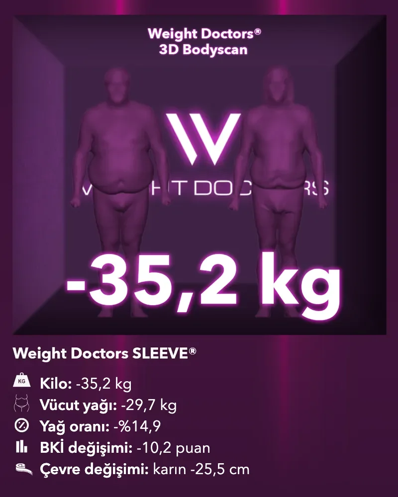 Weight Doctors® 3D Bodyscan öncesi ve sonrası: Weight Doctors SLEEVE® ile 35,2 kg eksi, vücut yağı 29,7 kg eksi