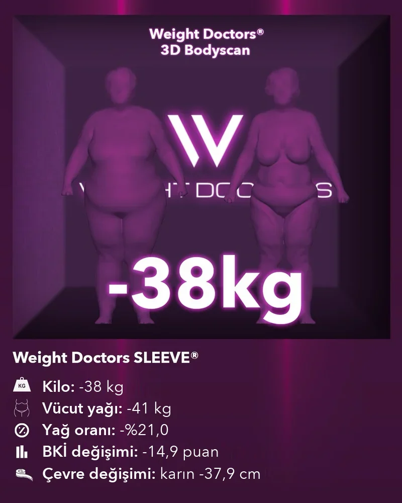 Weight Doctors® 3D Bodyscan öncesi ve sonrası: Weight Doctors SLEEVE® ile 38 kg eksi, vücut yağı 41 kg eksi