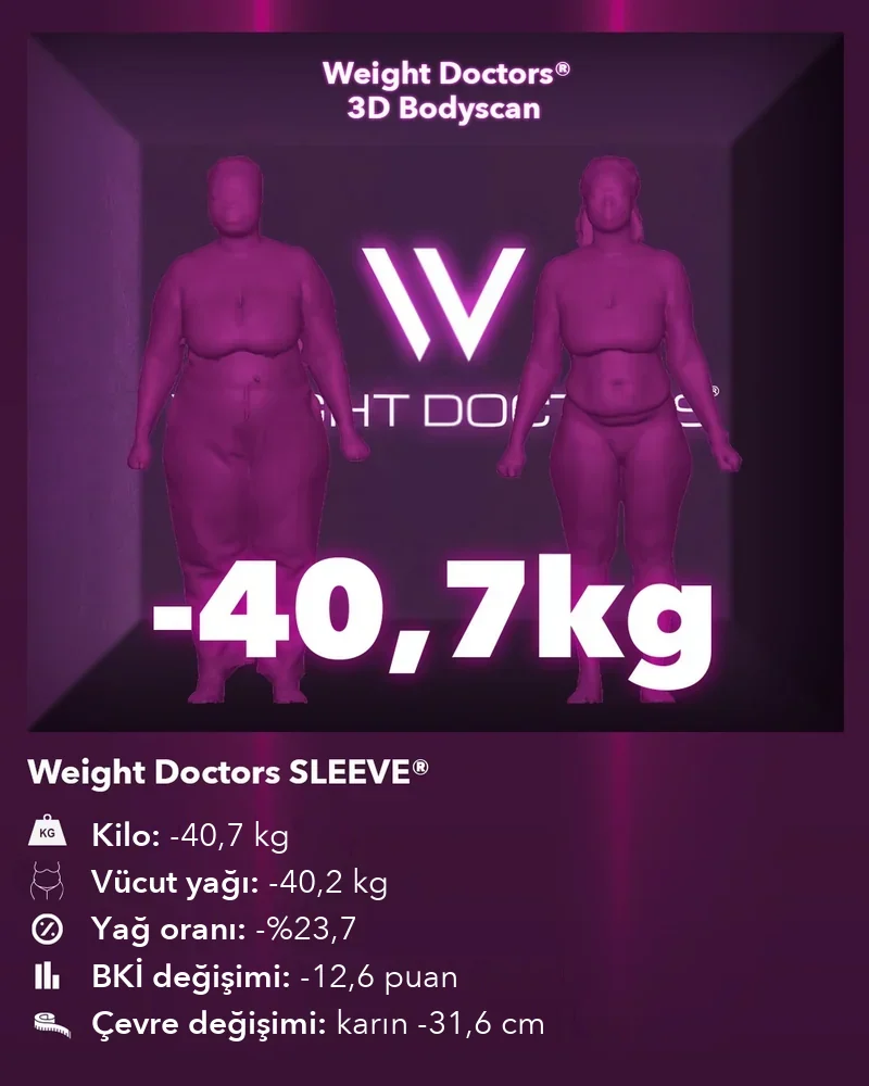Weight Doctors® 3D Bodyscan öncesi ve sonrası: Weight Doctors SLEEVE® ile 40,7 kg eksi, vücut yağı 40,2 kg eksi