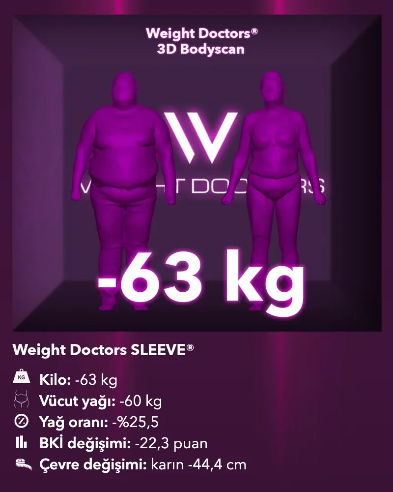 Weight Doctors® 3D Bodyscan öncesi ve sonrası: Weight Doctors SLEEVE® ile 63 kg eksi, vücut yağı 60 kg eksi